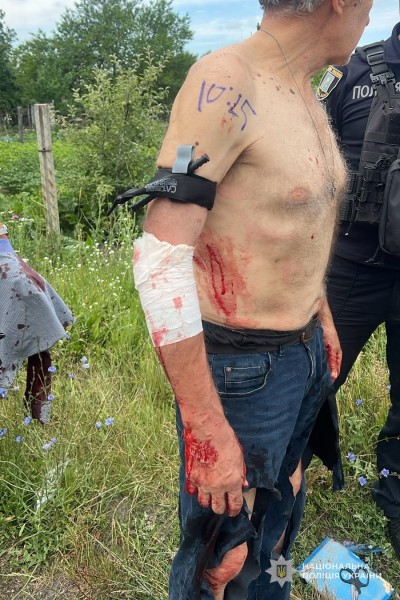 Коли рахунок іде на хвилини: на Сумщині поліцейські врятували пораненого після влучання БпЛА чоловіка + Відео