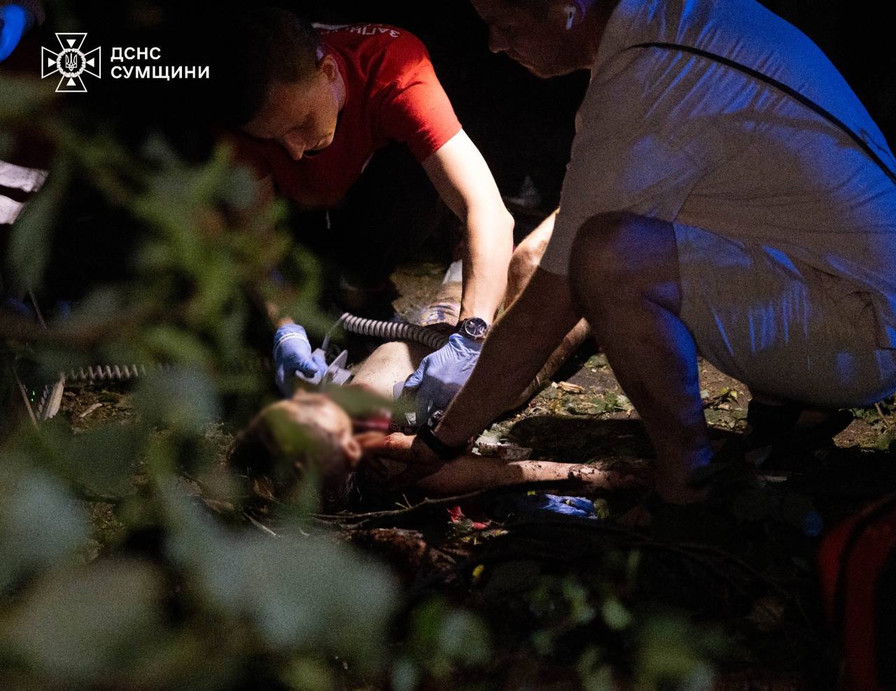 У лікарні помер чоловік, який був у критично важкому стані після удару КАБів по Сумах + Фото